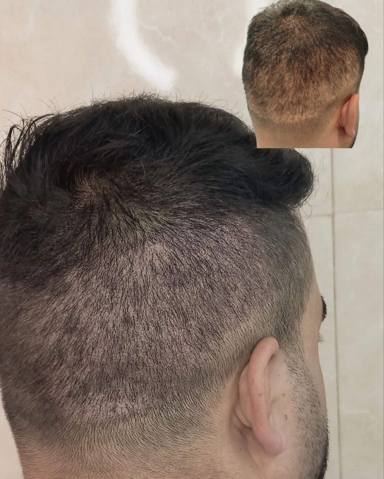 نمونه میکرواسکالپ